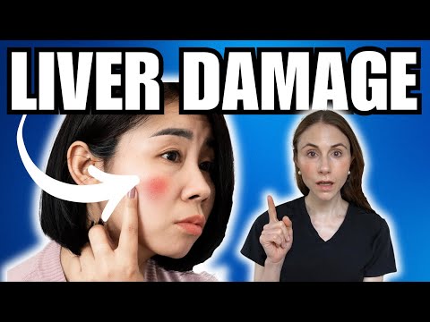 9 Warning Signs Of Liver Damage NOT TO MISS