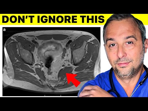 The Real Cause For Erectile Dysfunction Is Not What You Think