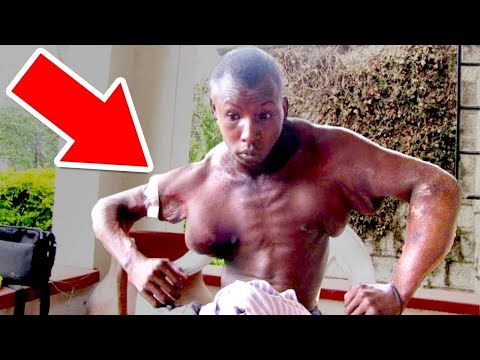 Wenn Fake-Muskeln Nach Hinten Losgehen