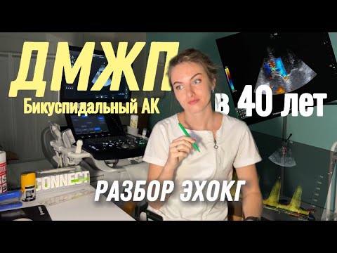 А вы ТАКОЕ ВИДЕЛИ? ДМЖП у 40 летнего мужчины! Бикуспидальный АК