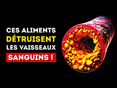 Ne mangez JAMAIS ces aliments si vous voulez garder vos vaisseaux sanguins en bonne santé