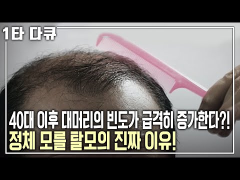 [김정철 탈모✨특강] 탈모 인구 천만 시대! 정체 모를 탈모의 진짜 이유, 그 베일을 벗긴다 | 김정철 경북대병원 모발이식센터 교수 | 아침마당 | KBS 2012.11.15 방송