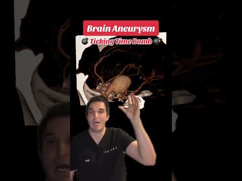 Giant brain aneurysm 💣