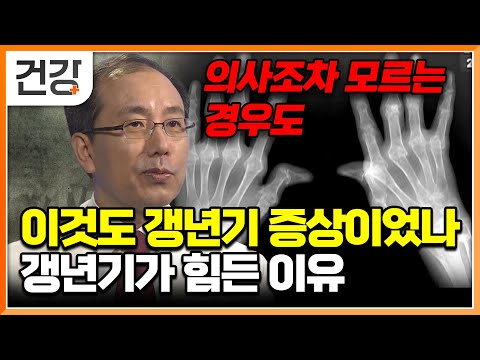 “갱년기가 이렇게까지 힘든 줄 몰랐어요” 몸이 보내는 이상 신호, 그냥 넘기지 마세요│명의│#EBS건강