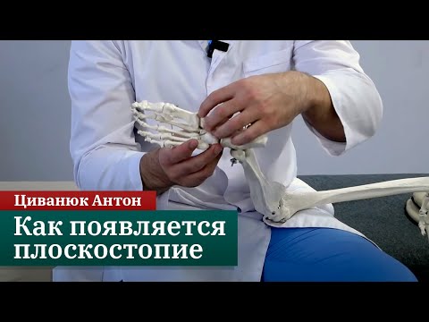 How Flat Feet Occurs. Leg Dysfunctions. Applied Kinesiology. Anton Tsivanuk