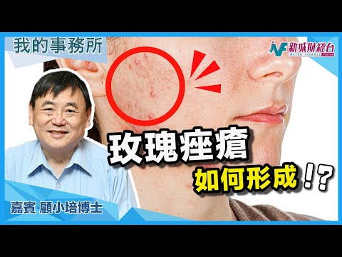 【我的事務所】生痘痘係因為沖熱水涼?玫瑰痤瘡點處理?呢種健康食品幫到你!|顧小培 劉婉芬