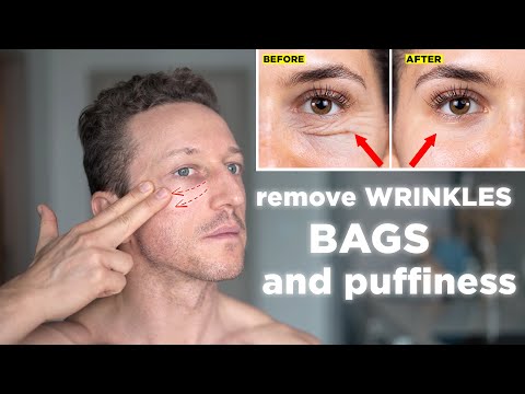 How To Remove Under Eye Bags And Wrinkles, 1-Minute Eye Massage
