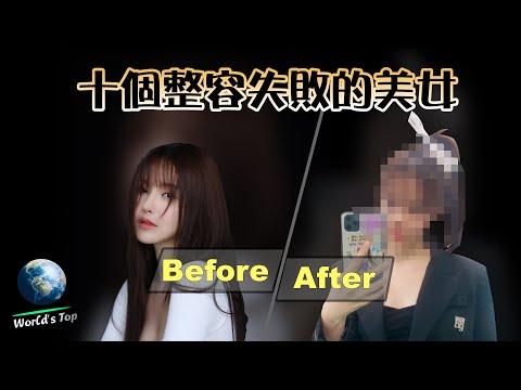 Spending more than one million in plastic surgery ? ! Celebrities that addicted to plastic surgery!