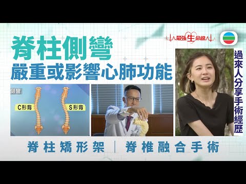 最強生命線|脊柱側彎:嚴重或影響心肺功能 (繁 / 簡字幕)|醫療|治療|無綫新聞|TVB News