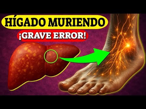 13 Signos Extraños de DAÑO HEPÁTICO que puedes ver - ¡El Hígado está Muriendo!