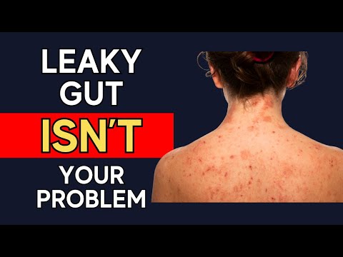 How To Get Rid Of Eczema And Chronic Skin Problems When Functional Medicine Fails