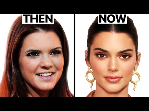 What Happened to Kendall Jenner's Face? | Plastic Surgery Analysis