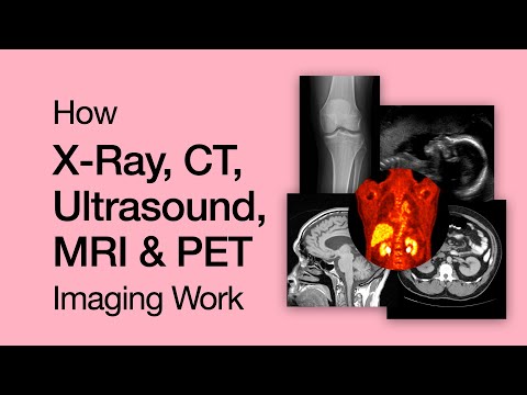 The Science behind X-ray, CT, Ultrasound, MRI & PET Imaging
