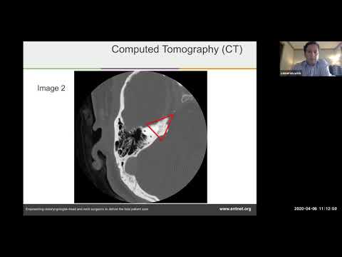 Temporal bone imaging - Dr. Cameron Wick