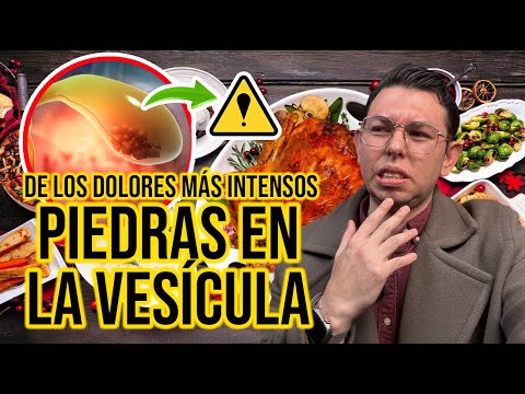 ¿Por eso salen las PIEDRAS EN VESICULA? | DrPoloGuerrero