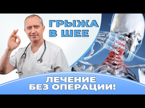 Cervical disc herniation. Treatment without surgery!