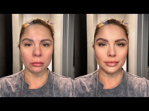 ПОДТЯНУТЬ ЛИЦО ЗА 10 МИНУТ | Легкий массаж лица в домашних условиях #фейсфитнес #массажлица