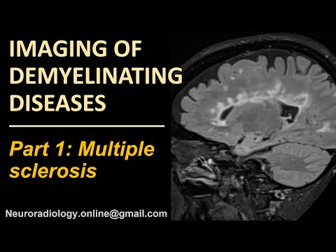 Imaging of Multipe Sclerosis