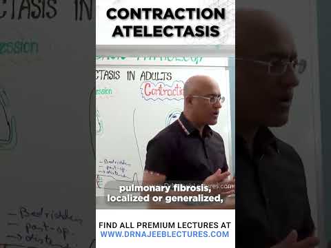 Contraction Atelectasis #drnajeeb #drnajeeblectures #shortvideostatus
