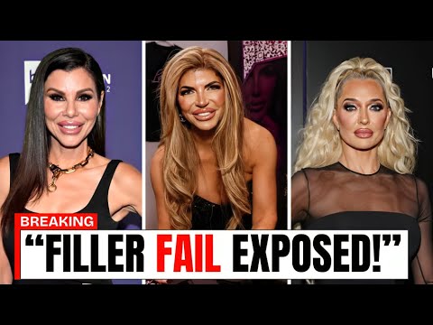 10 Real Housewives Filler & Botox Gone WRONG!