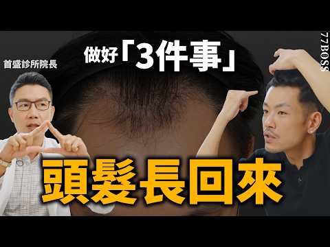 禿頭怎麼辦？吃藥、雷射、打針、植髮哪個好？延緩、治療最有效的是！？【77老大】