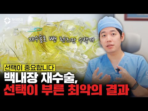 백내장 재수술 선택이 중요한 이유