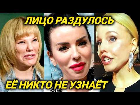 Изменилась до НЕУЗНАВАЕМОСТИ. Звезды 2025 ДО и ПОСЛЕ пластических операций