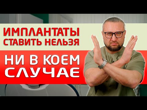 Настаивают на установке имплантов? Не предлагают другие варианты протезирования, кроме имплантации?