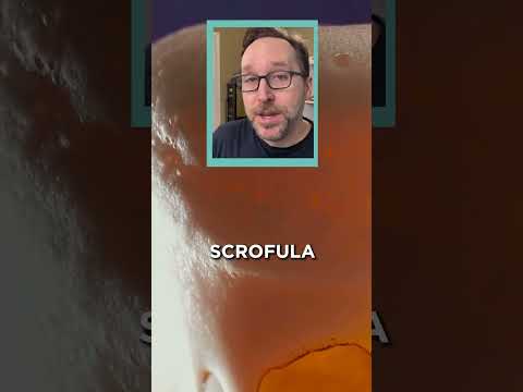 A Short List Of Diseases That You Can Smell