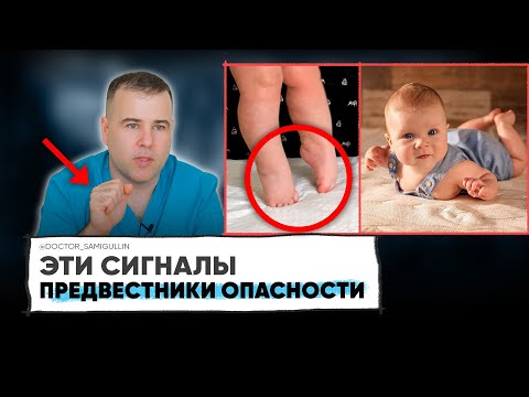 6 СИГНАЛОВ, когда СРОЧНО нужно обратиться к специалисту. Не пропусти эти СИГНАЛЫ в развитии ребенка