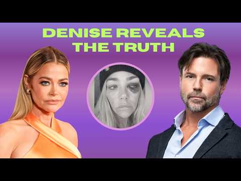 Denise Richards' Divorce EXPLODES: Abuse, Affairs & Financial SHOWDOWN