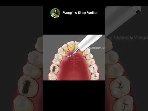 Super Healing ASMR Animation! Satisfying Tartar Removal! | Meng's Stop Motion