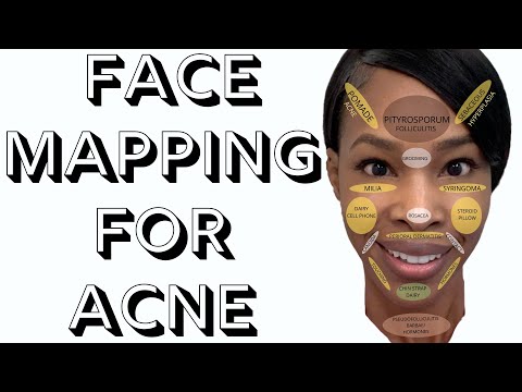 Face Mapping For Acne