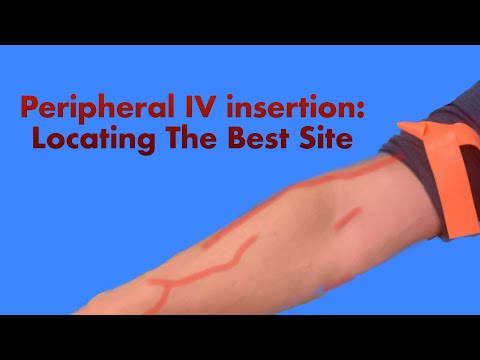 Peripheral IV Insertion: Locating the Best Site