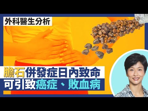 膽石引發癌症惡性腫瘤？膽石併發症一兩日內可致命！膽管炎 膽囊膽汁倒流傷肝、細菌入血變敗血病｜王建芳醫生 陳詩正醫生｜人類健康研究所
