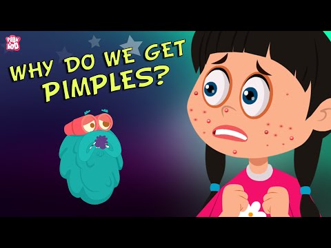 Why Do We Get Pimples? The Dr. Binocs Show | Best Learning Videos For Kids | Peekaboo Kidz
