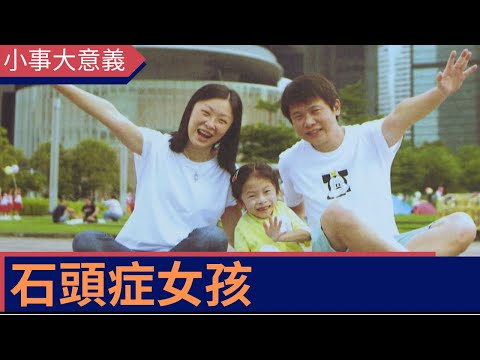 【小事大意義】石頭症女孩  ：石頭症女孩傷口會鈣化成骨頭  媽媽用正能量陪伴囡囡面對挑戰
