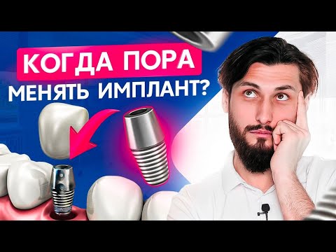 Что будет с зубными имплантами через 10 лет? Срок службы зубных имплантов