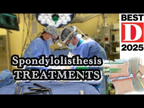 "Cure" for Spondylolisthesis and Instability?!