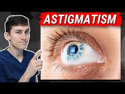 Astigmatism Explained - What You Need to Know!