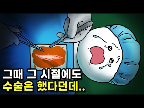 마취제 발명 전에는 어떻게 수술했을까?