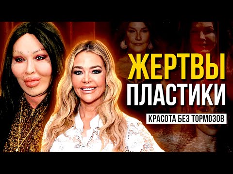 PLASTIC SURGERY VICTIMS: They LOST the race for beauty