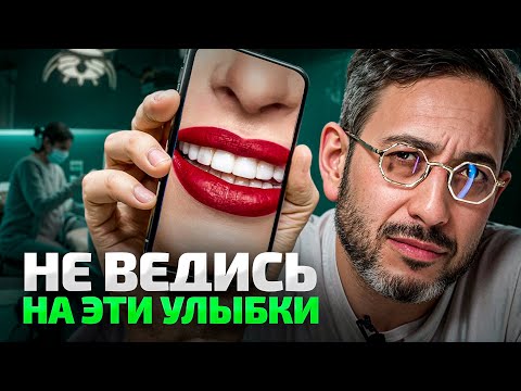 ВИНИРЫ в 2025: Как НЕ разрушить зубы ради «красоты»?