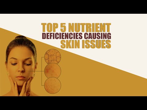 Top 5 Nutrient Deficiencies Causing Skin Issues | Shivangi Desai