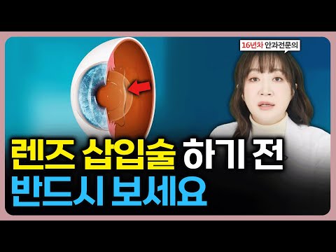 렌즈삽입술? 라식 라섹? 수술 전에 무조건 봐야 하는 영상(#안과전문의)