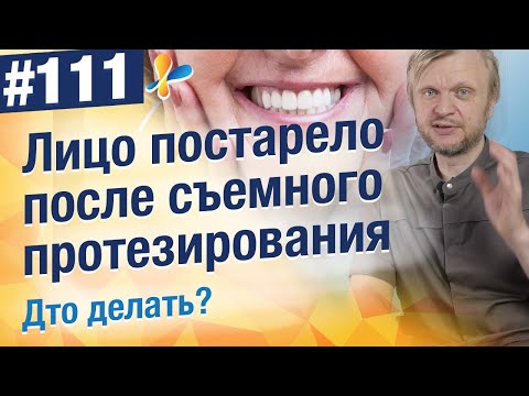 Куда исчезли губы? Как съёмные протезы меняют внешность