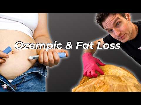 What Ozempic & Weight Loss Drugs Really Do to the Body