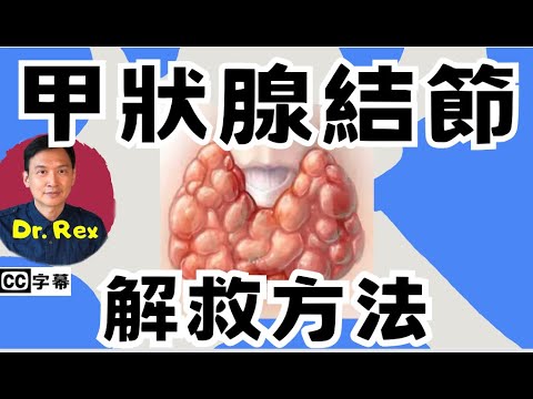 如何改善甲狀腺結節？ 什麼病徵顯示甲狀腺結節是腫瘤？
