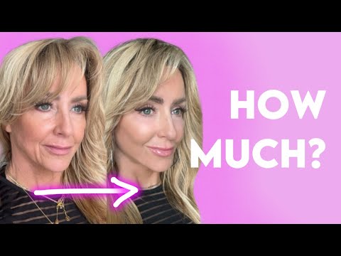 Chalene Johnson's Facelift Cost 💰 I have receipts