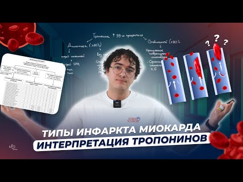 Типы инфаркта миокарда. Интерпретация тропонина